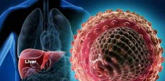 viral hepatitis types symptoms causes prevention and treatment