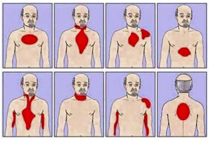 Types of Angina