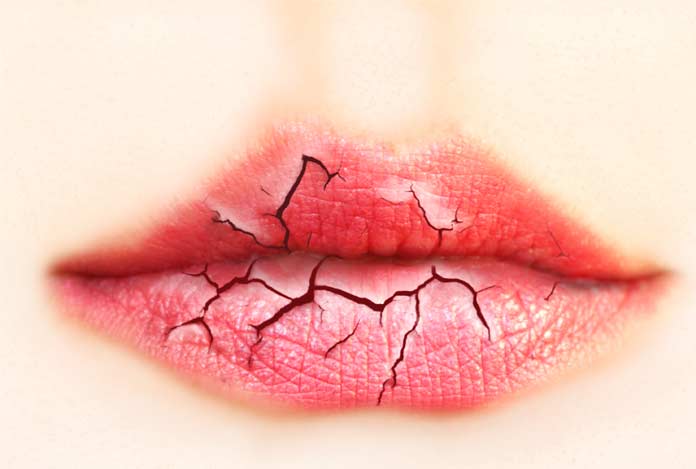 Dry mouth for Cannabidiol — Benefits and Effects