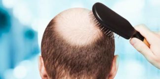 Is Hair Loss Related to Age?