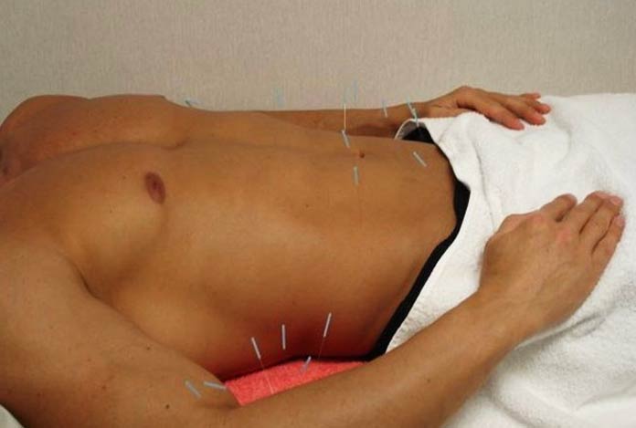 Treatment for inferlity in men for Acupuncture Treatment for Infertility – How Effective It Is?