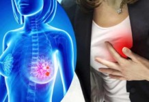 breast cancer treatment might increase risk of cardiovascular diseases