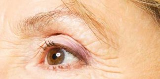 for 30s try these best antiwrinkle methods
