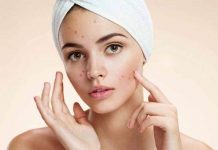 get rid of acnepimples 7 effective home remedies