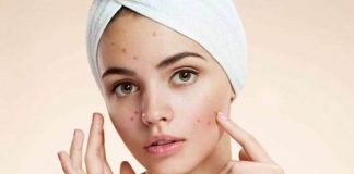 get rid of acnepimples 7 effective home remedies