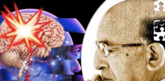 Patients are at high risk of dementia even after years of traumatic brain injuries