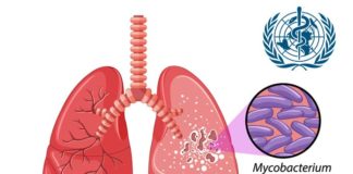 Tuberculosis – Current Scenario and A Run-through of Its Control Programmes Tuberculosis Current Scenario and A Run through of Its Control Programm1