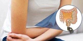 constipation types causes symptoms and natural ways to cure