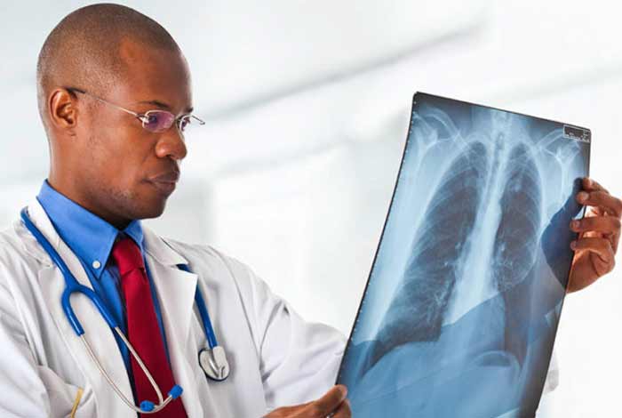 diagnosis of lung cancer