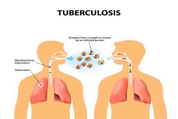 transmission of tb 