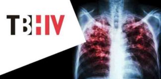 tuberculosis world’s deadliest infection alongside aids