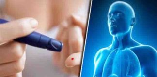 Type 3c Diabetes – A Misdiagnosed Form of Type II Diabetes type 3c diabetes – a misdiagnosed form of type II diabetes