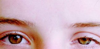 Things You Must Know About Horner's Syndrome