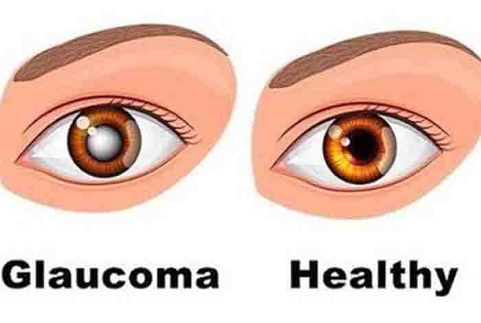 glaucoma