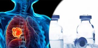 lung cancer and its most common drug list