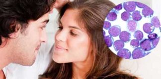 Mono Virus That May Spread Through Kissing Is Linked to 7 Other Diseases mono virus that may spread through kissing Is linked to 7 other diseases