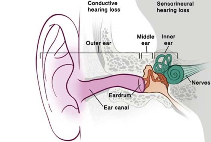 types and symptoms of hearing loss