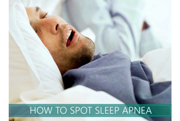 Sleep Apnea