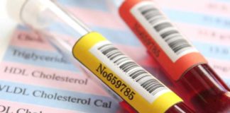 All You Need To Know About Triglycerides