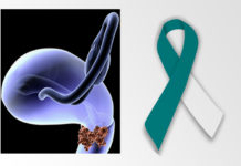 Cervical Cancer