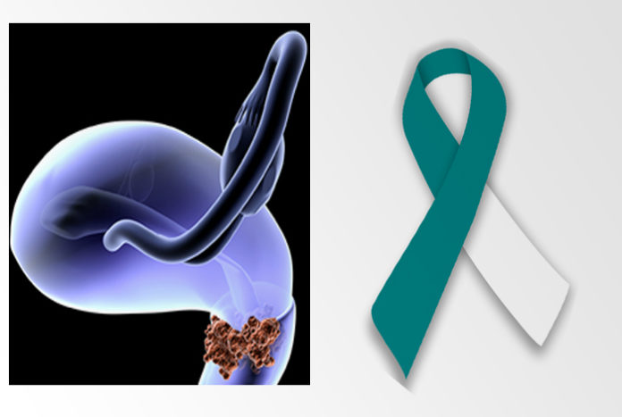 Cervical Cancer