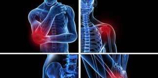 Non-Conventional Ways of Treating Bursitis by Dr. Weil