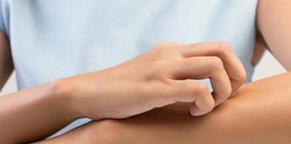 Treating Eczema with Vitamin B12 Cream