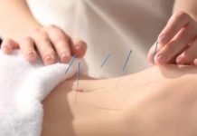 Acupuncture Doesn’t Boost Fertility, a Study Finds acupuncture doesnt boost fertility a study finds