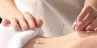 acupuncture doesnt boost fertility a study finds