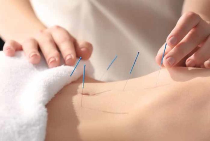 acupuncture doesnt boost fertility a study finds