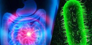 Cholera – Causes, Symptoms, Treatment and Prevention cholera causes symptoms treatment and prevention