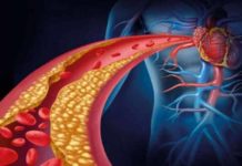 Gut Microbes Can Help Reduce the Risk of Heart Disease, a Study Confirms gut microbes can help reduce the risk of heart disease a study confirms