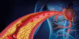 gut microbes can help reduce the risk of heart disease a study confirms