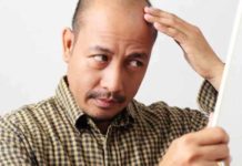 Osteoporosis Drug Might Be a Potential Solution to Male Pattern Baldness steoporosis drug might be a potential solution to male pattern baldness