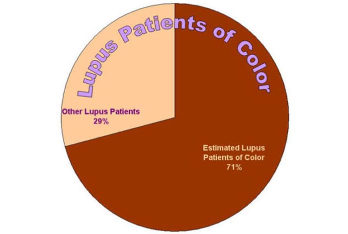 overview and statistical facts of lupus