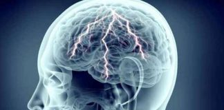 Seizures – Types, Symptoms, Causes, Diagnosis, Prevention and Treatment seizures types symptoms causes diagnosis prevention and treatment