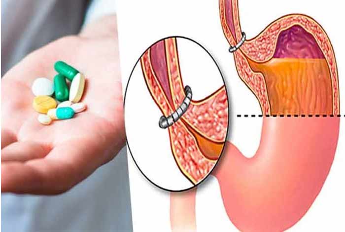 treatment of gerd