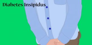 diabetes insipidus symptoms diagnosis and treatment