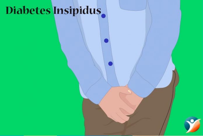 diabetes insipidus symptoms diagnosis and treatment