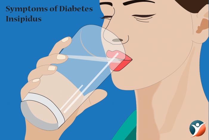 diabetes insipidus symptoms