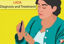 LADA diagnosis and treatment