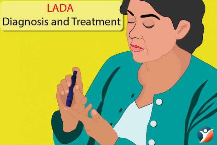 LADA diagnosis and treatment