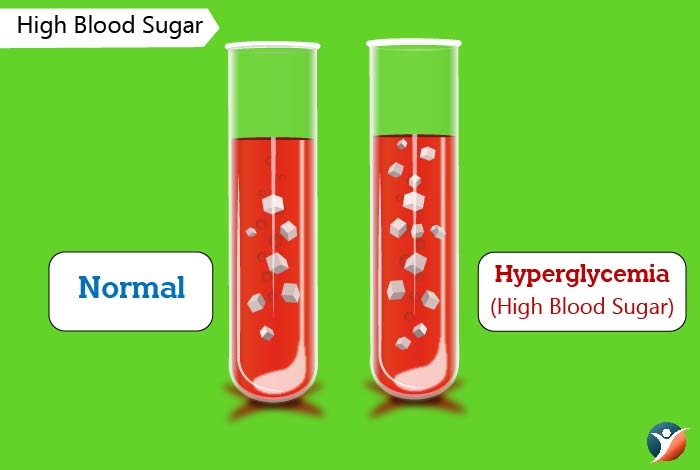 high blood sugar in diabetes