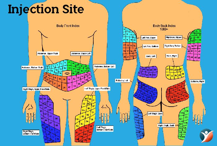 Insulin Injection Sites Diagram Printable