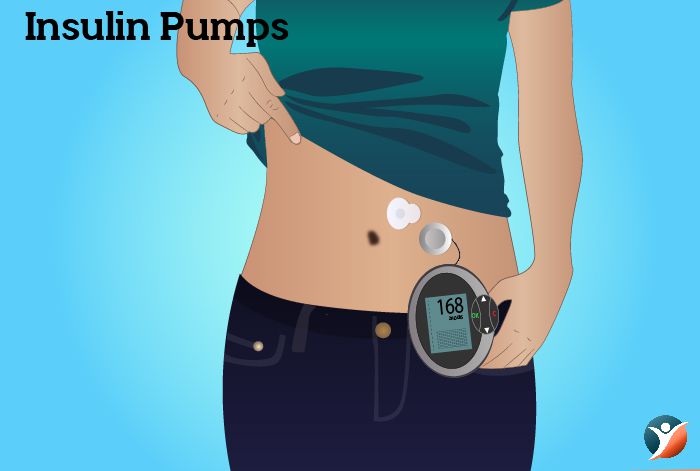 insulin pumps
