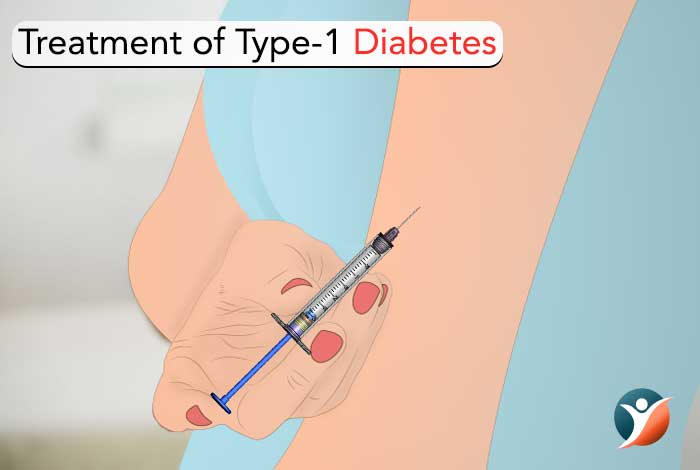 type 1 diabetes treatment 