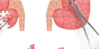 end stage kidney disease a transplant alarm