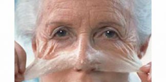 Metformin