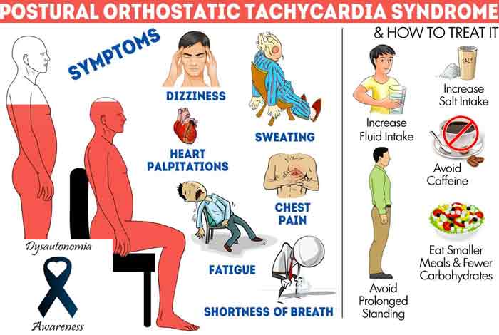 pots-postural-orthostatic-tachycardia-syndrome-what-is-it