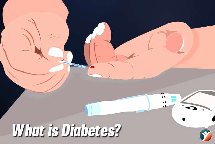 What is Diabetes?